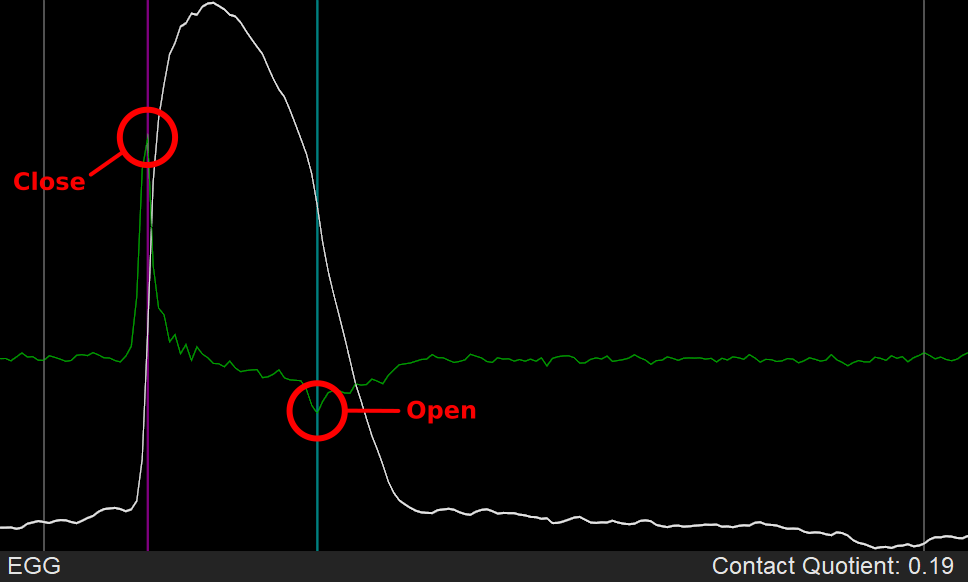 Using dEGG maximum for glottal closure, and dEGG minimum for opening